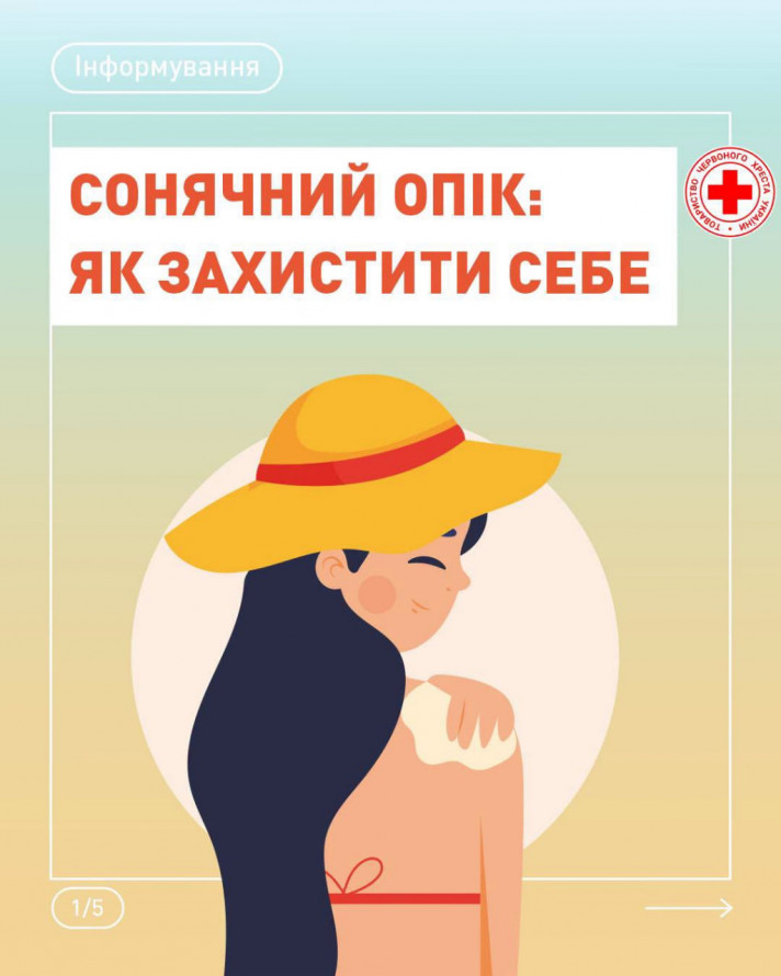 Як запоріжцям зберегти молодість та здоров'я шкіри під літнім яскравим сонцем - поради