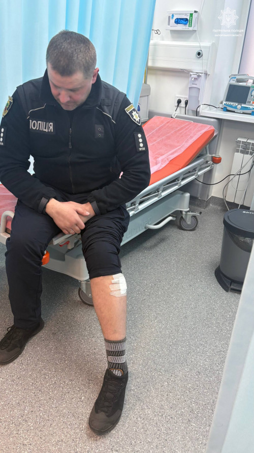 Ворог майже 900 разів обстріляв Запорізьку область: поранені двоє поліцейських (фото)