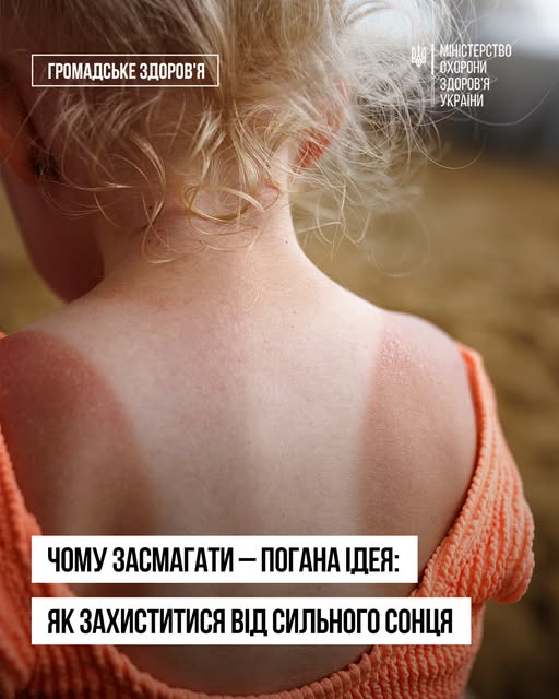 Як запоріжцям зберегти молодість та здоров'я шкіри під літнім яскравим сонцем - поради