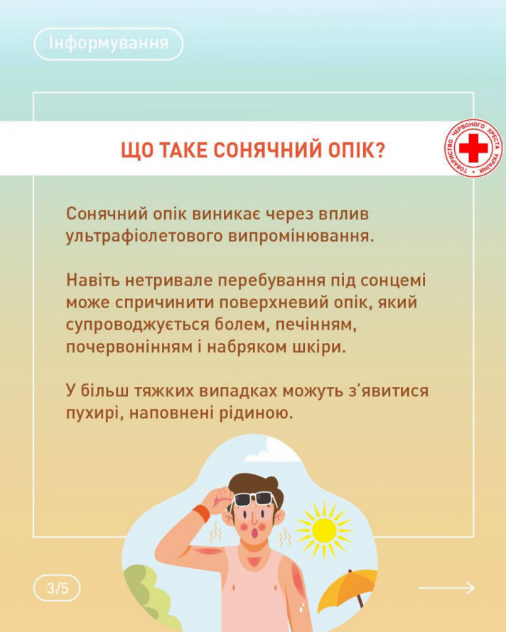 Як запоріжцям зберегти молодість та здоров'я шкіри під літнім яскравим сонцем - поради