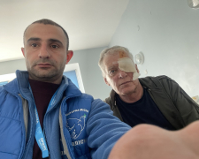 Потрапив під масовану атаку - переселенець з Пологівського району отримав тяжкі поранення під час обстрілу Запоріжжя (фото)