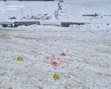 "Народився в сорочці" - підліток із Запоріжжя вижив після пострілу в голову