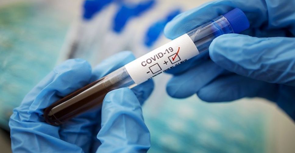 В Украине выявили более 33 тысяч новых случаев коронавируса