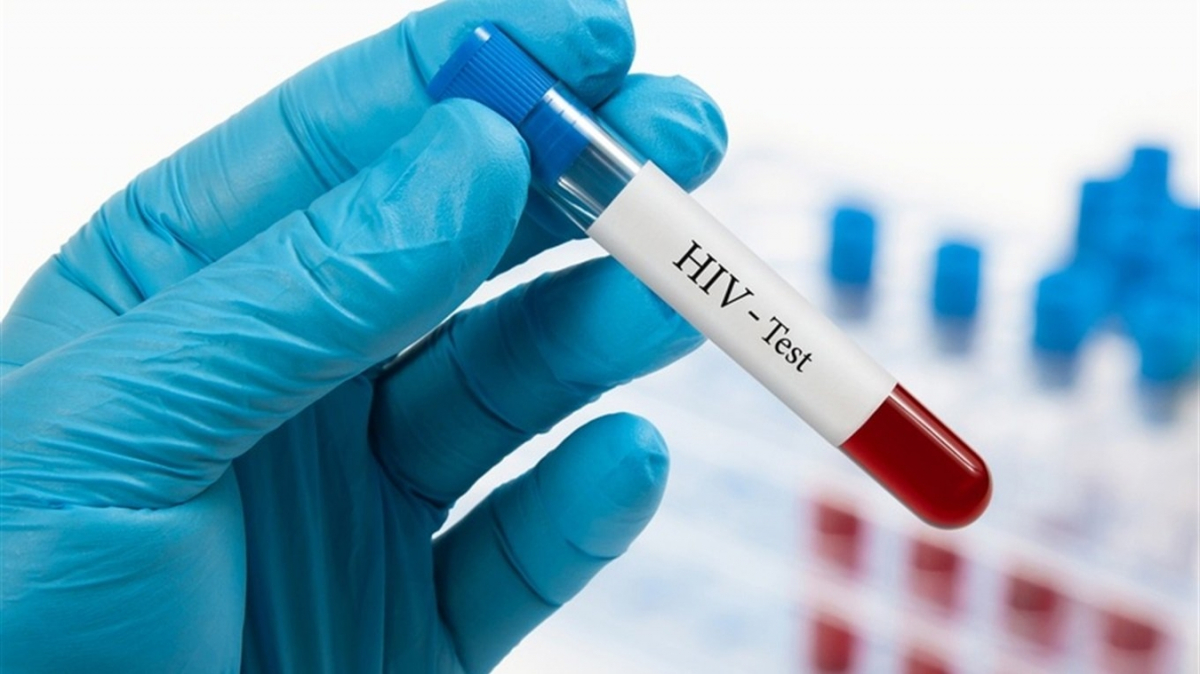 В окупованому Мелітополі стрімко зростає кількість випадків ВІЛ та гепатитів - в чому причина