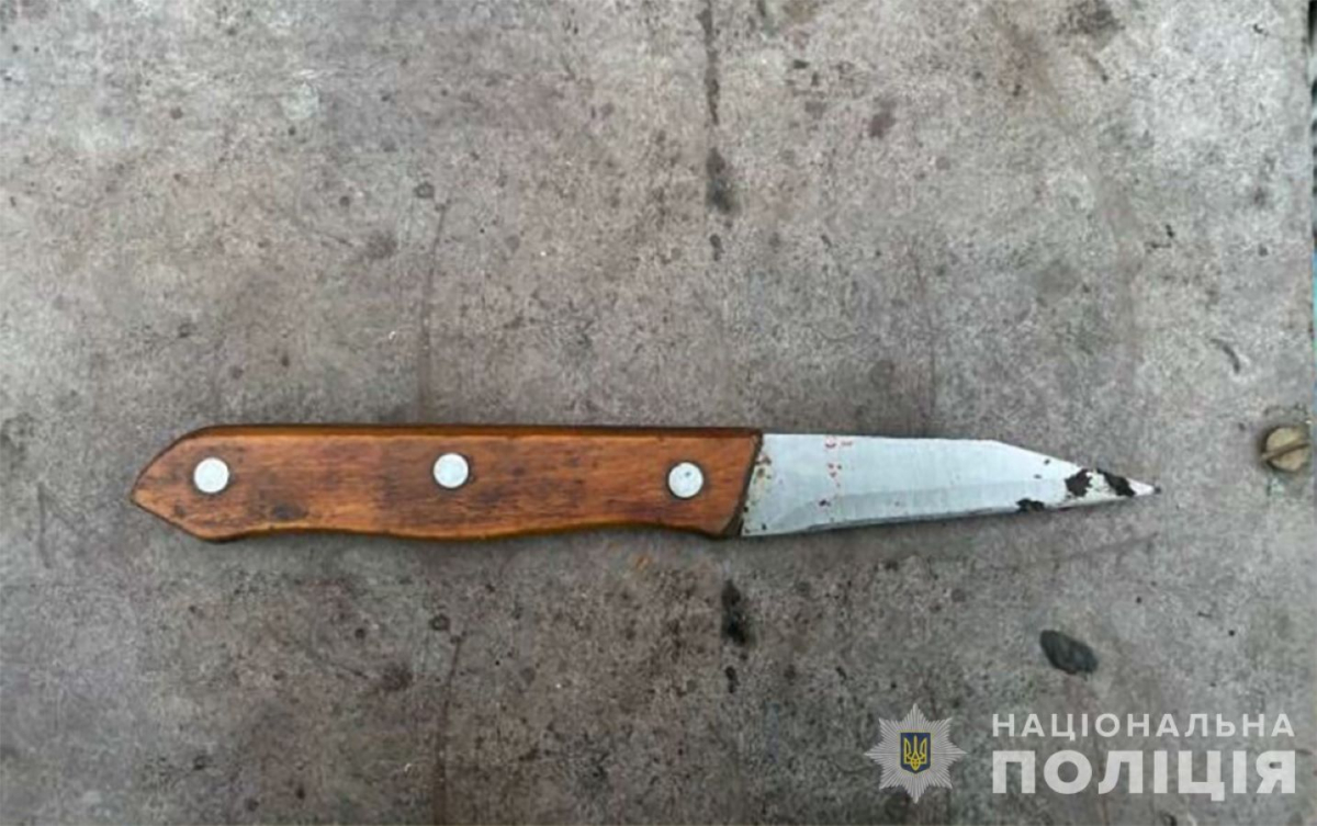 Запоріжець отримав сильний удар ножем прямо на вулиці - чи знайшли нападника