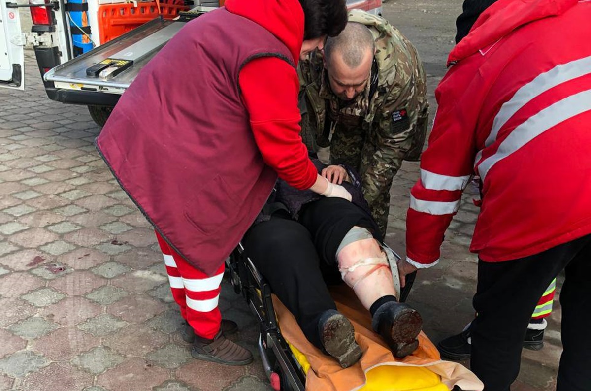 У селищі Запорізького району домашні собаки напали на пенсіонерку - жінка в лікарні (фото, відео)