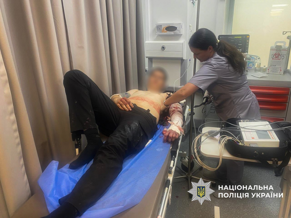 У Запоріжжі поліцейський застрелив чоловіка під час нападу на правоохоронців